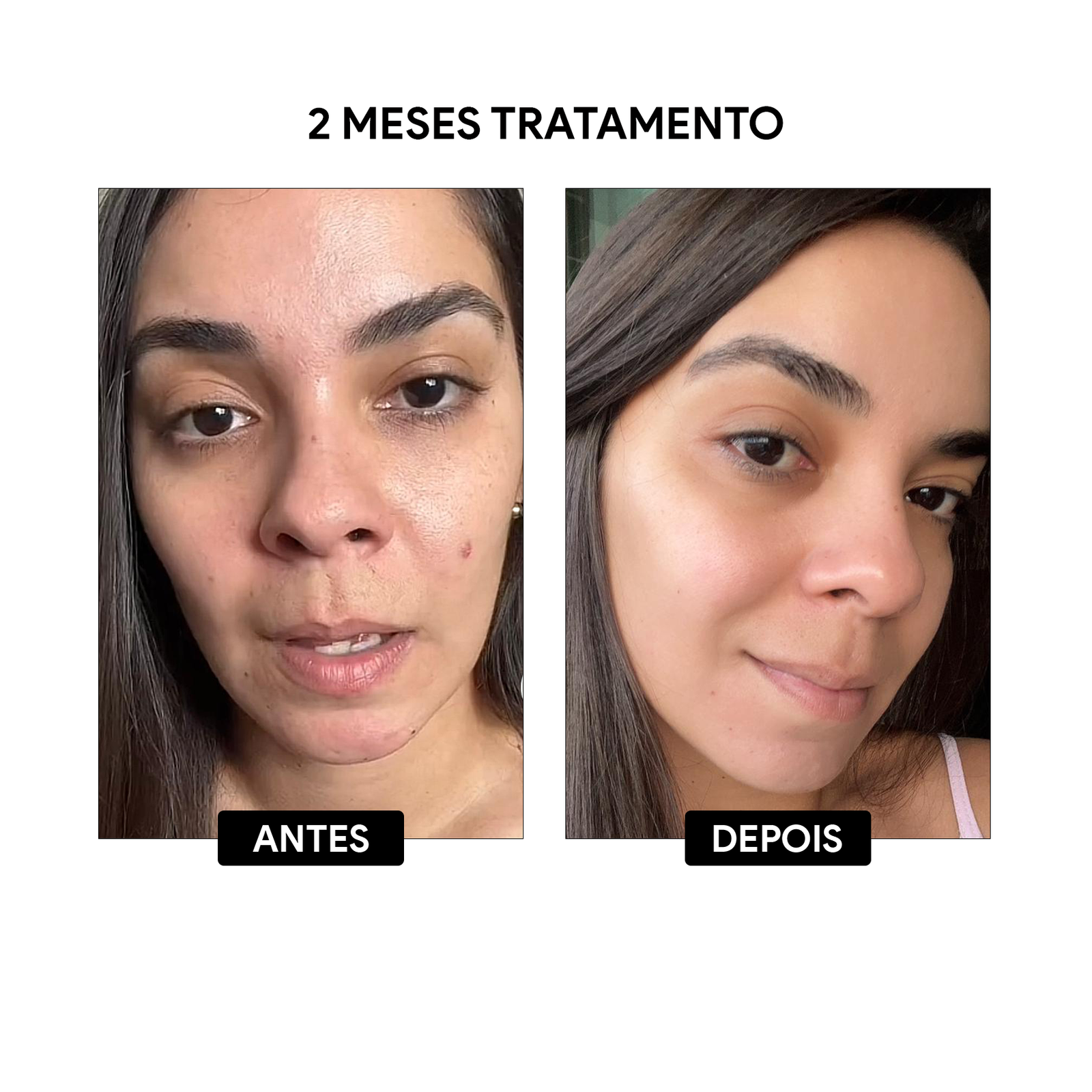 antes-e-depois03.png